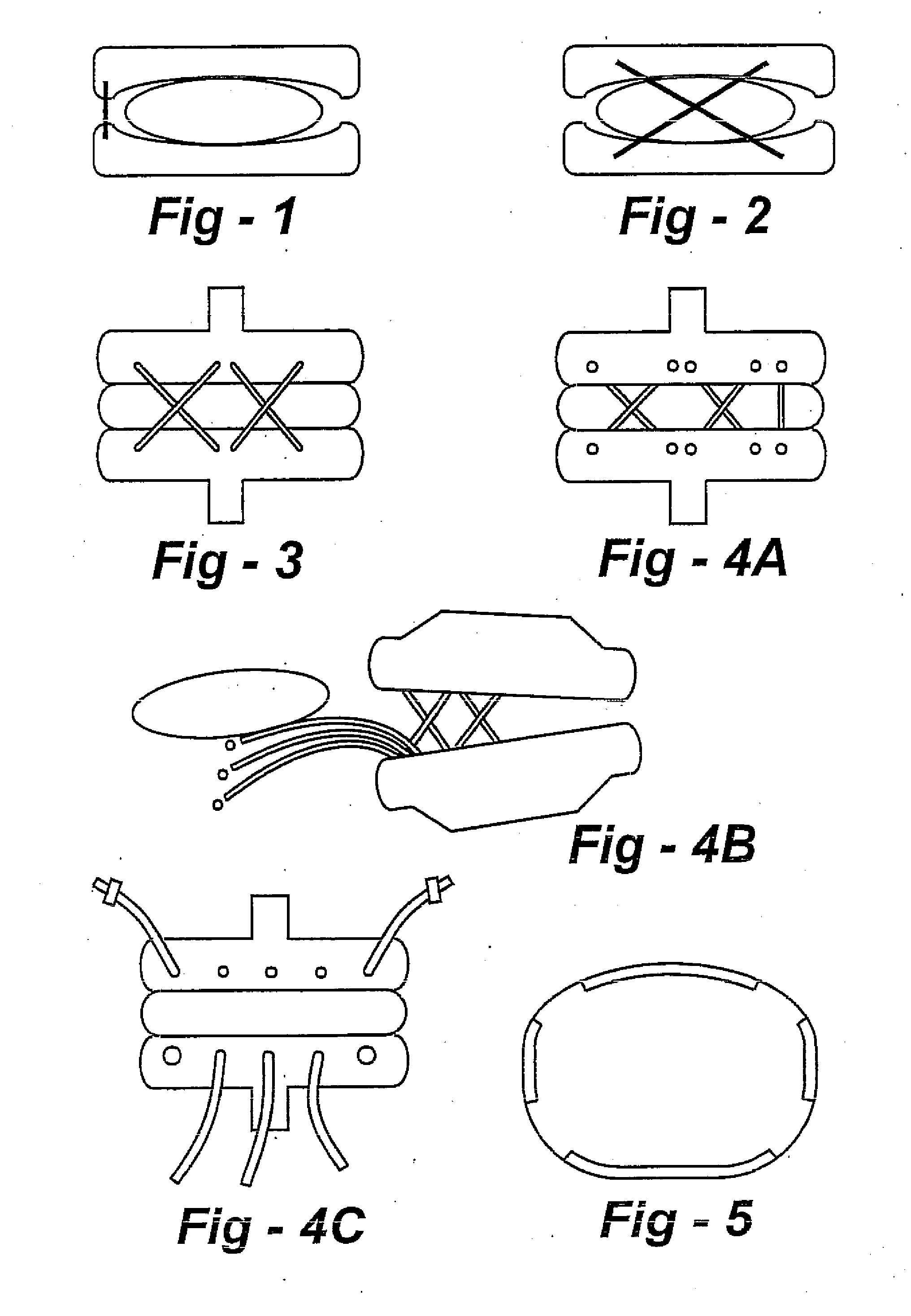 Check reins for artificial disc replacements