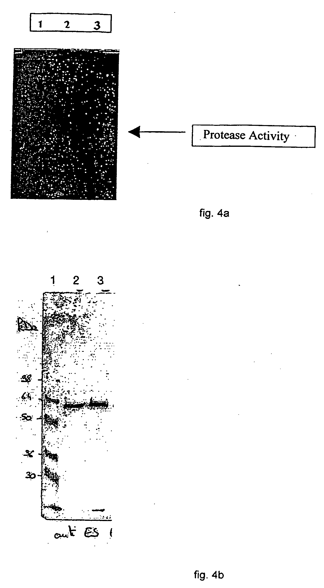 Vaccine complex for preventing or treating leishmaniases