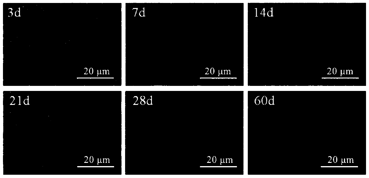 Zinc-based alloy membrane for guided bone tissue regeneration