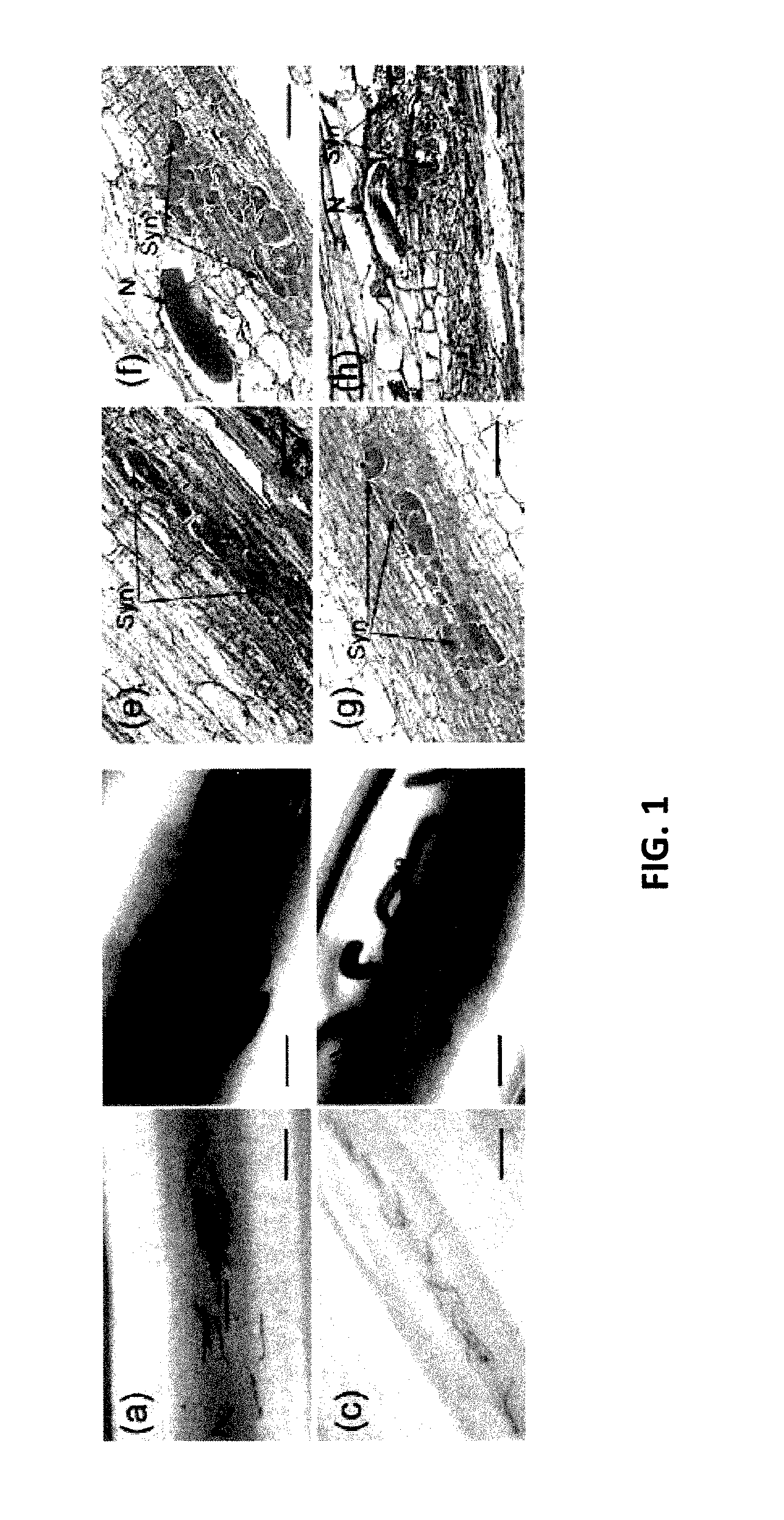 Genes implicated in resistance to soybean cyst nematode infection and methods of their use