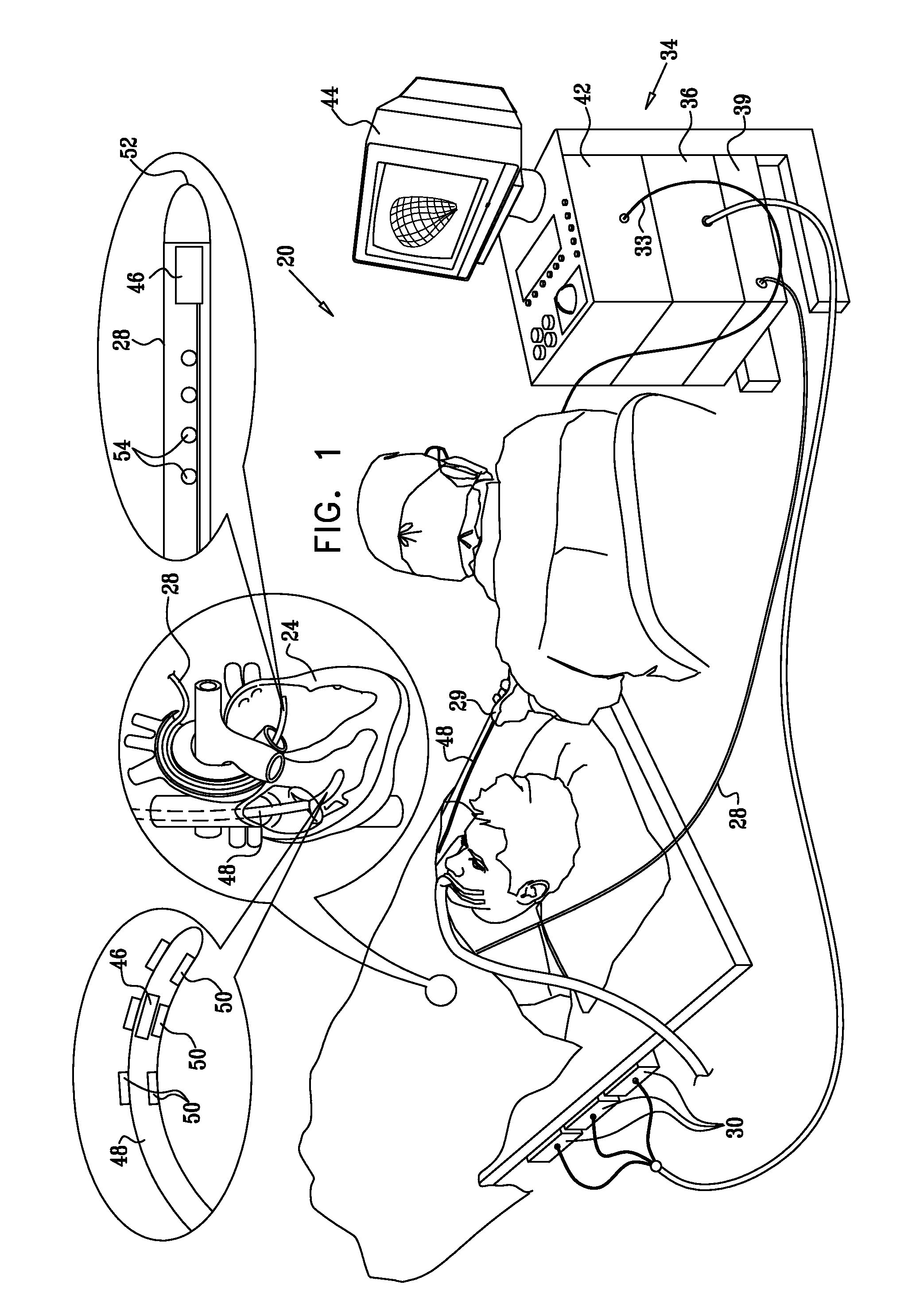 Coloring electroanatomical maps to indicate ultrasound data acquisition