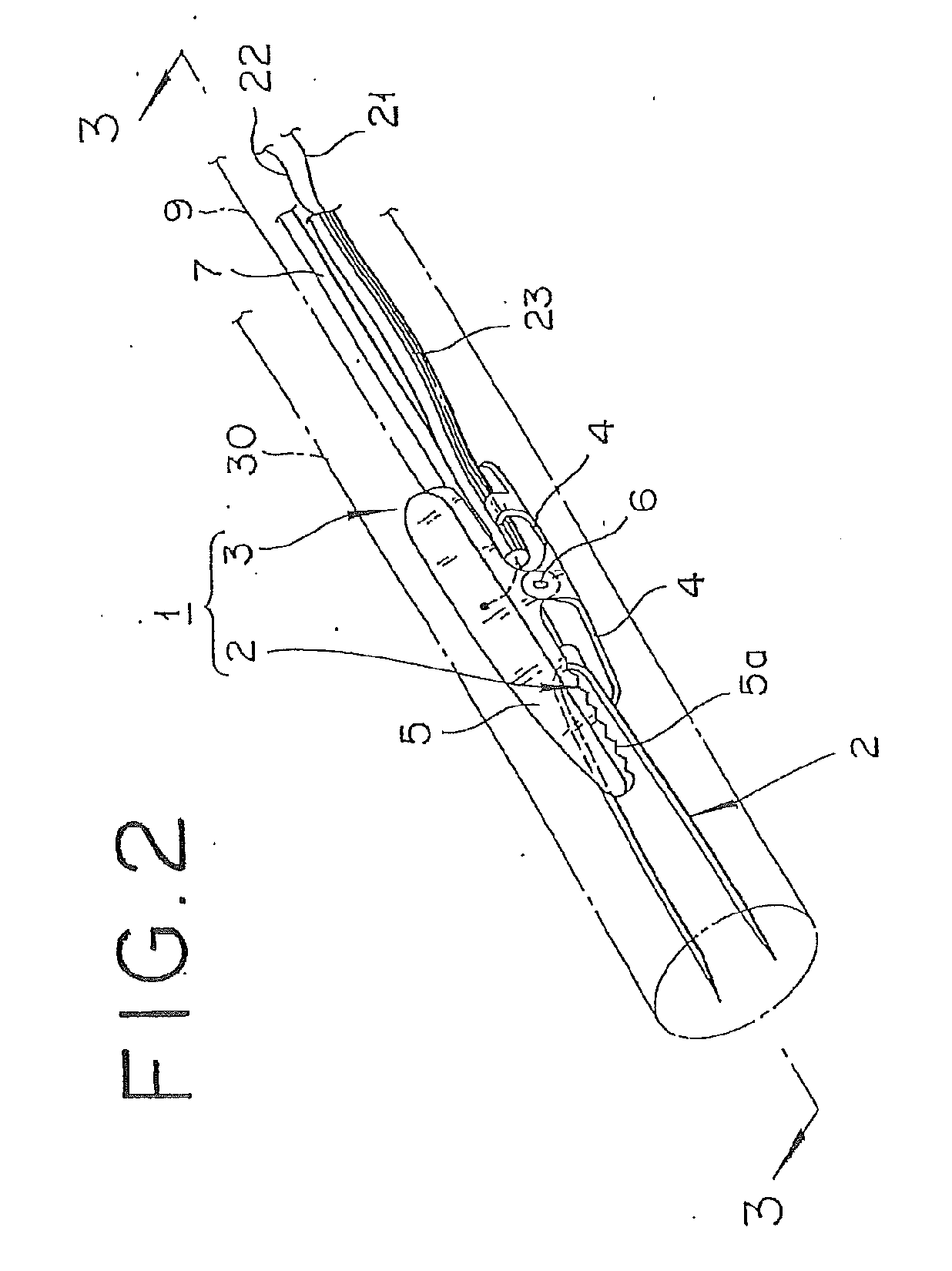 Pfo closing device