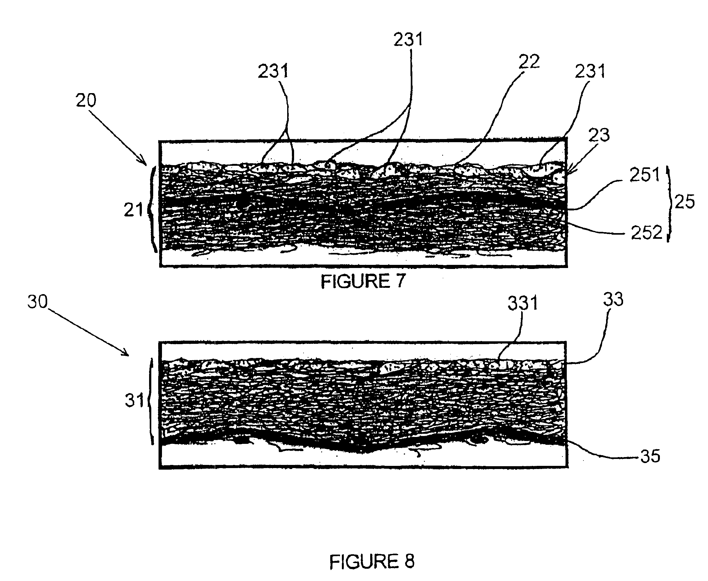 Screen formed from a stretched flexible surface bearing a print