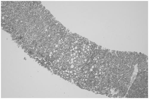 Liquid feed and method for constructing cynomolgus monkey alcoholic liver disease model