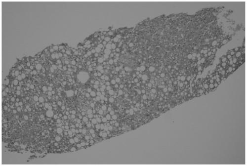 Liquid feed and method for constructing cynomolgus monkey alcoholic liver disease model