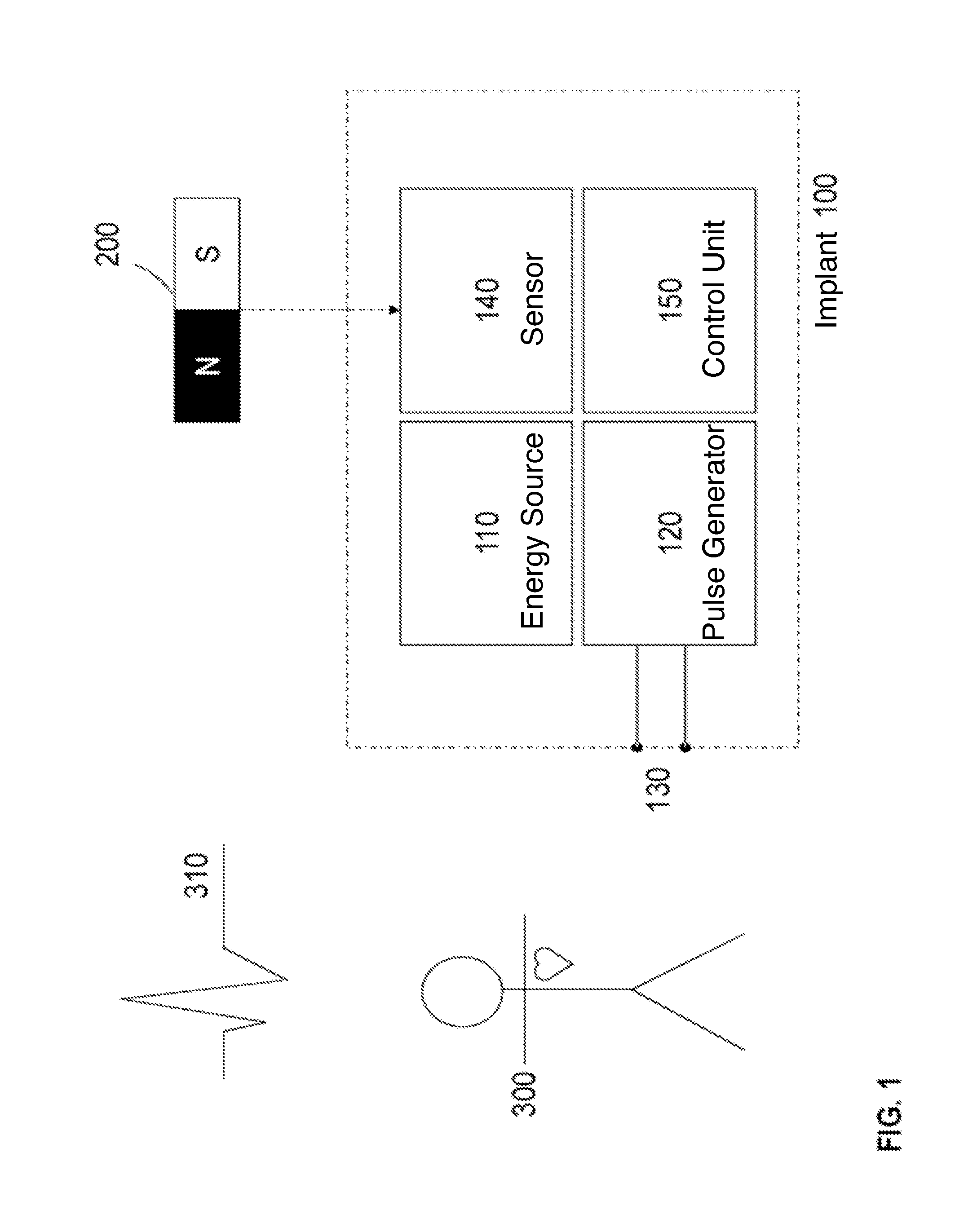 Medical implant with a communications interface