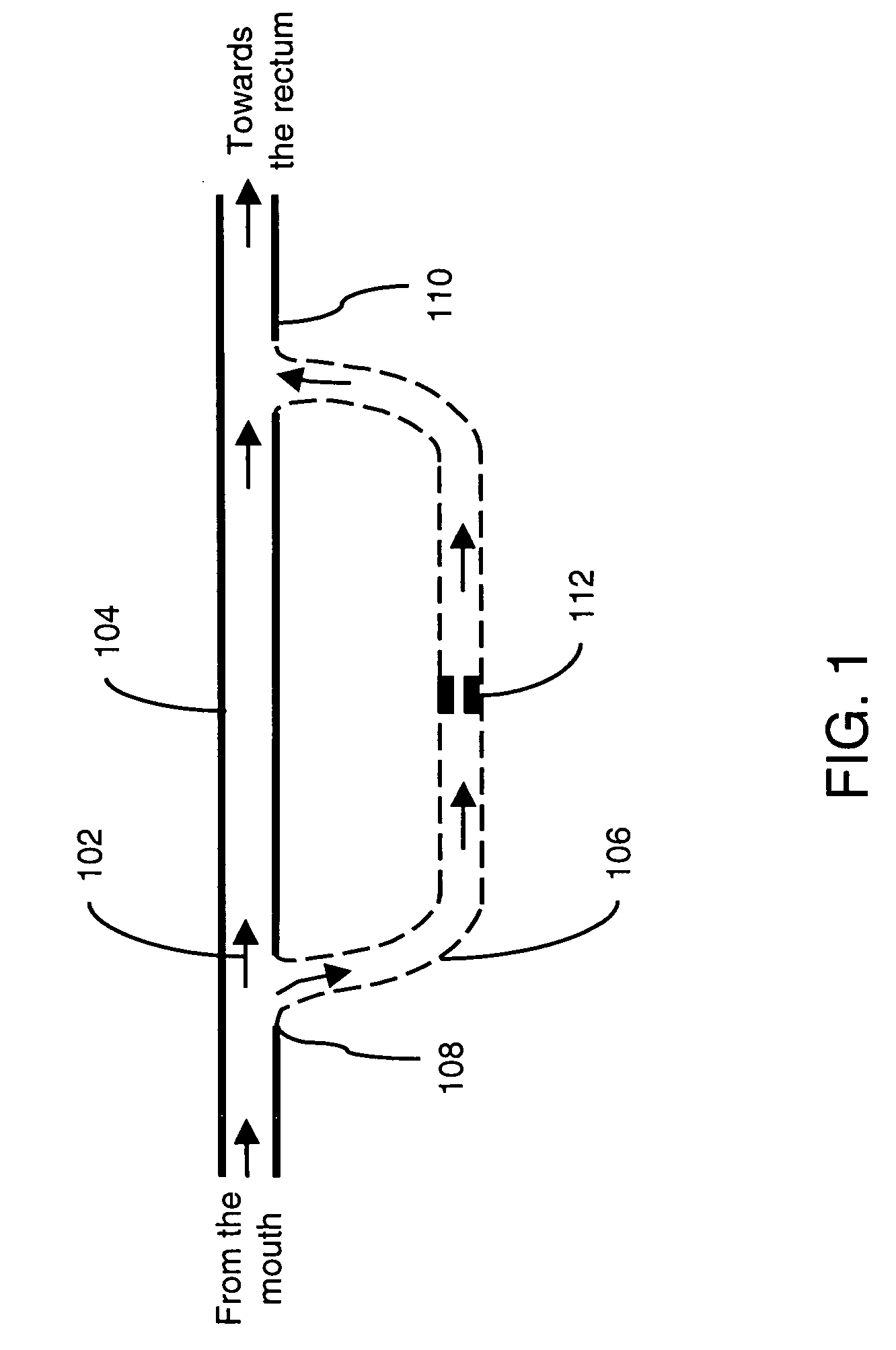 Method and device for gastrointestinal bypass