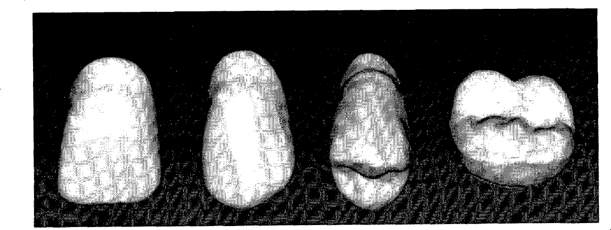 A design and manufacture method of complete denture based on cad/rp technology