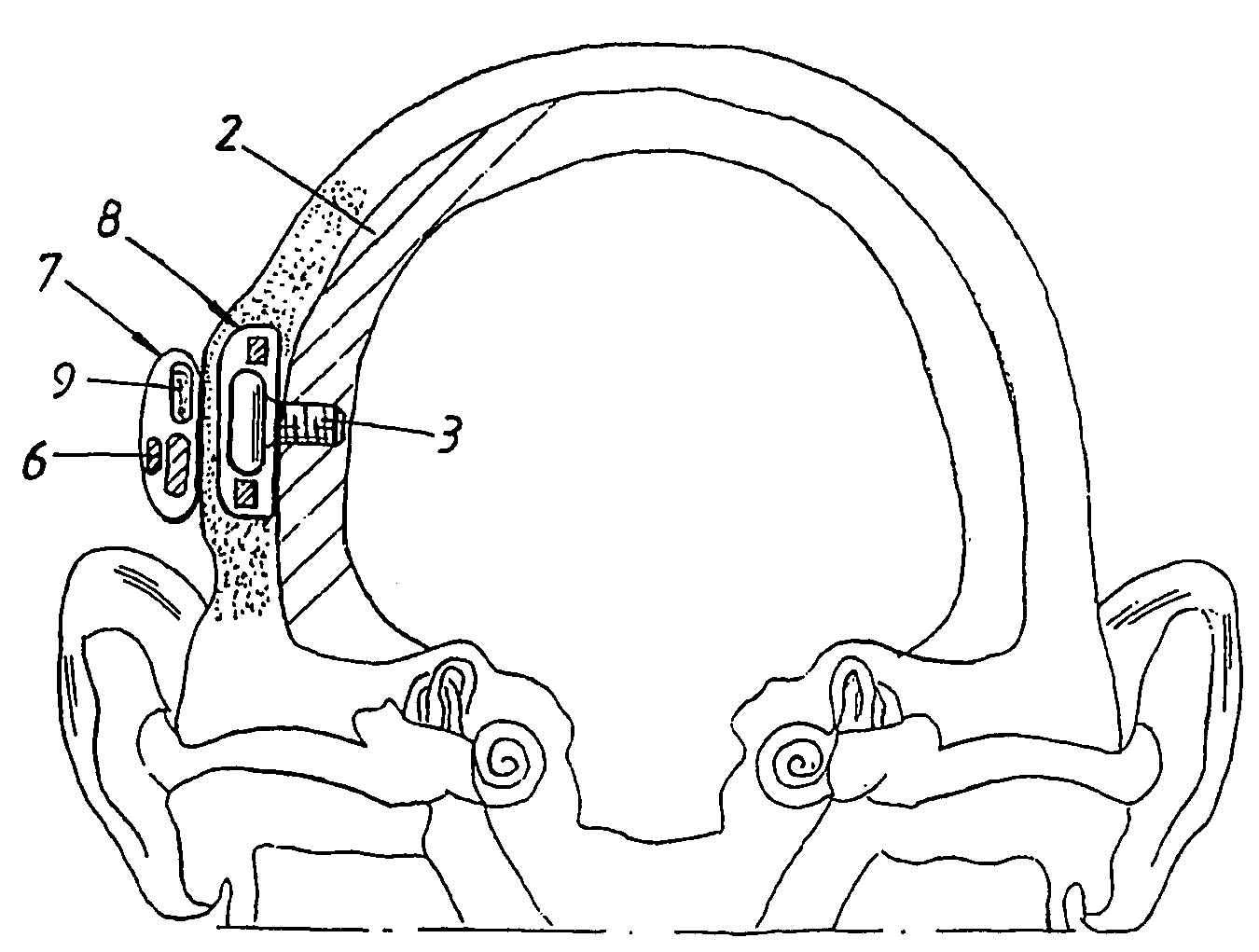 Hearing aid apparatus