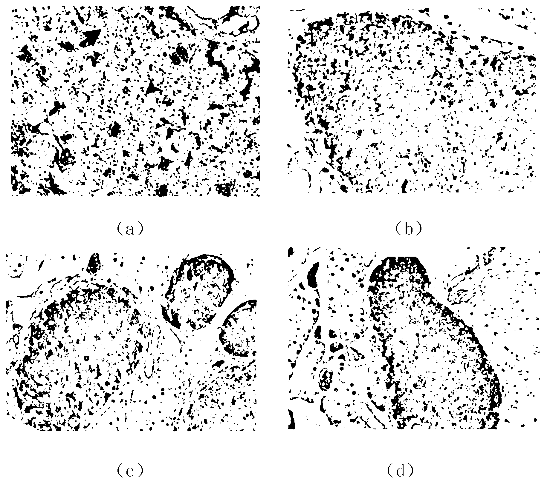 Application of beta-catenin and gene