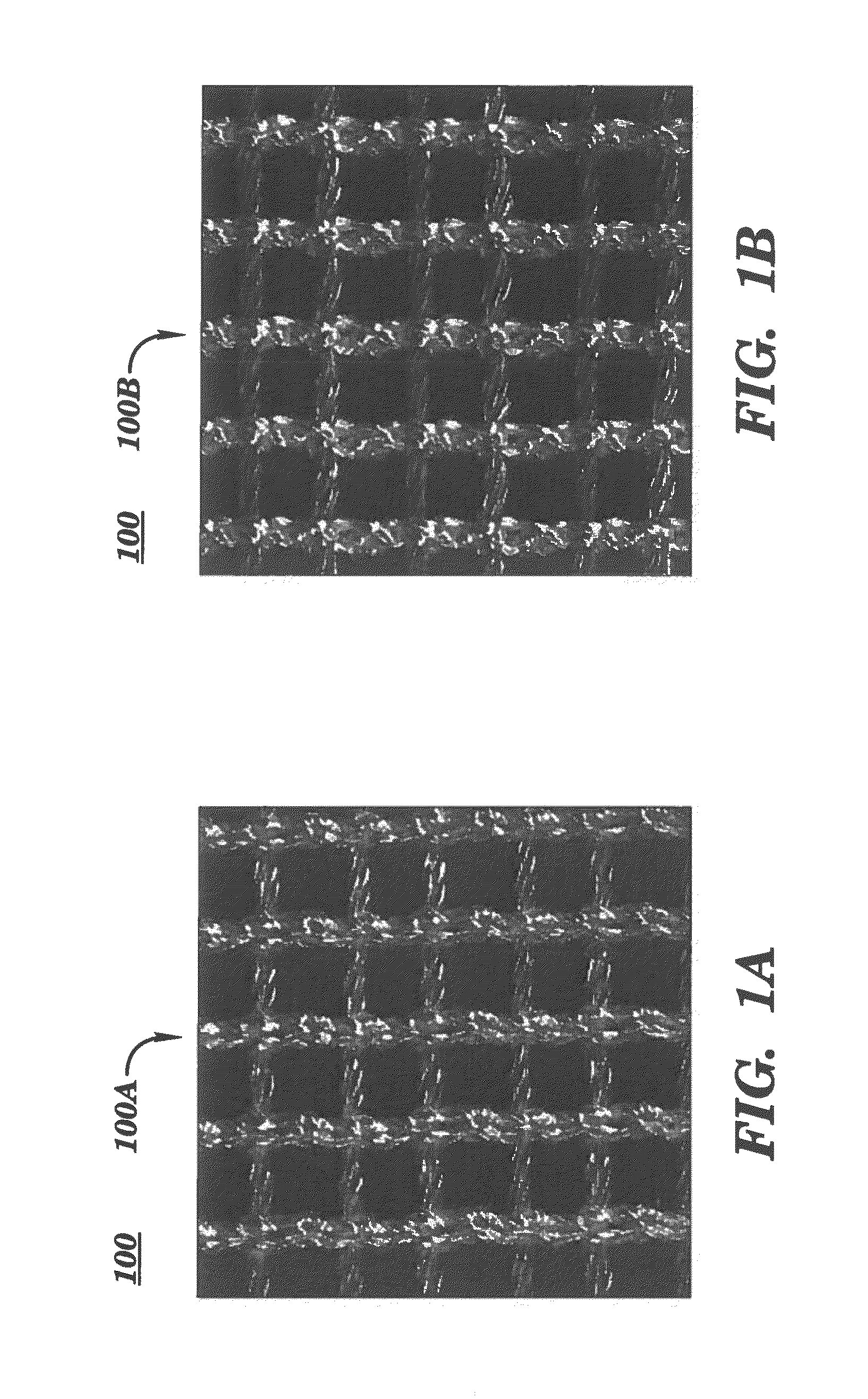 Silk medical device for use in breast augmentation and breast reconstruction