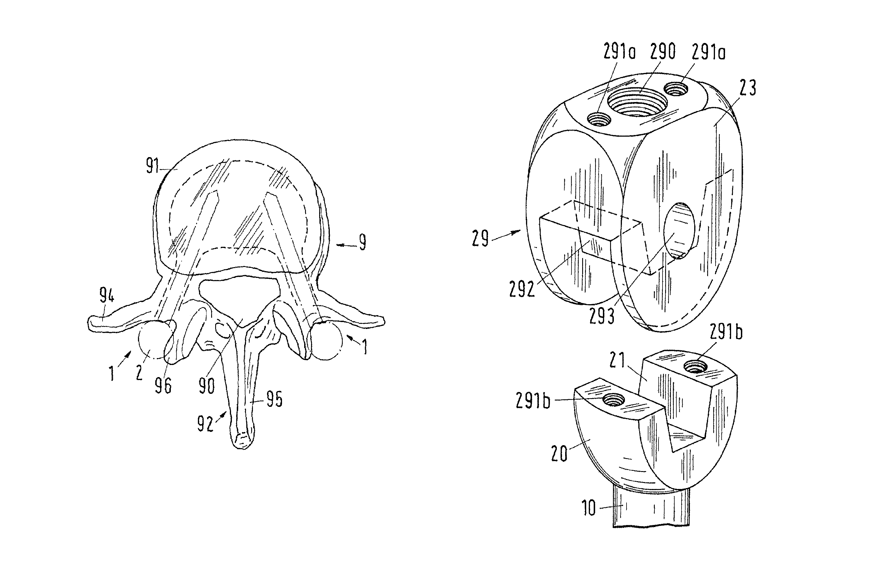 Pedicle screw for intervertebral support elements