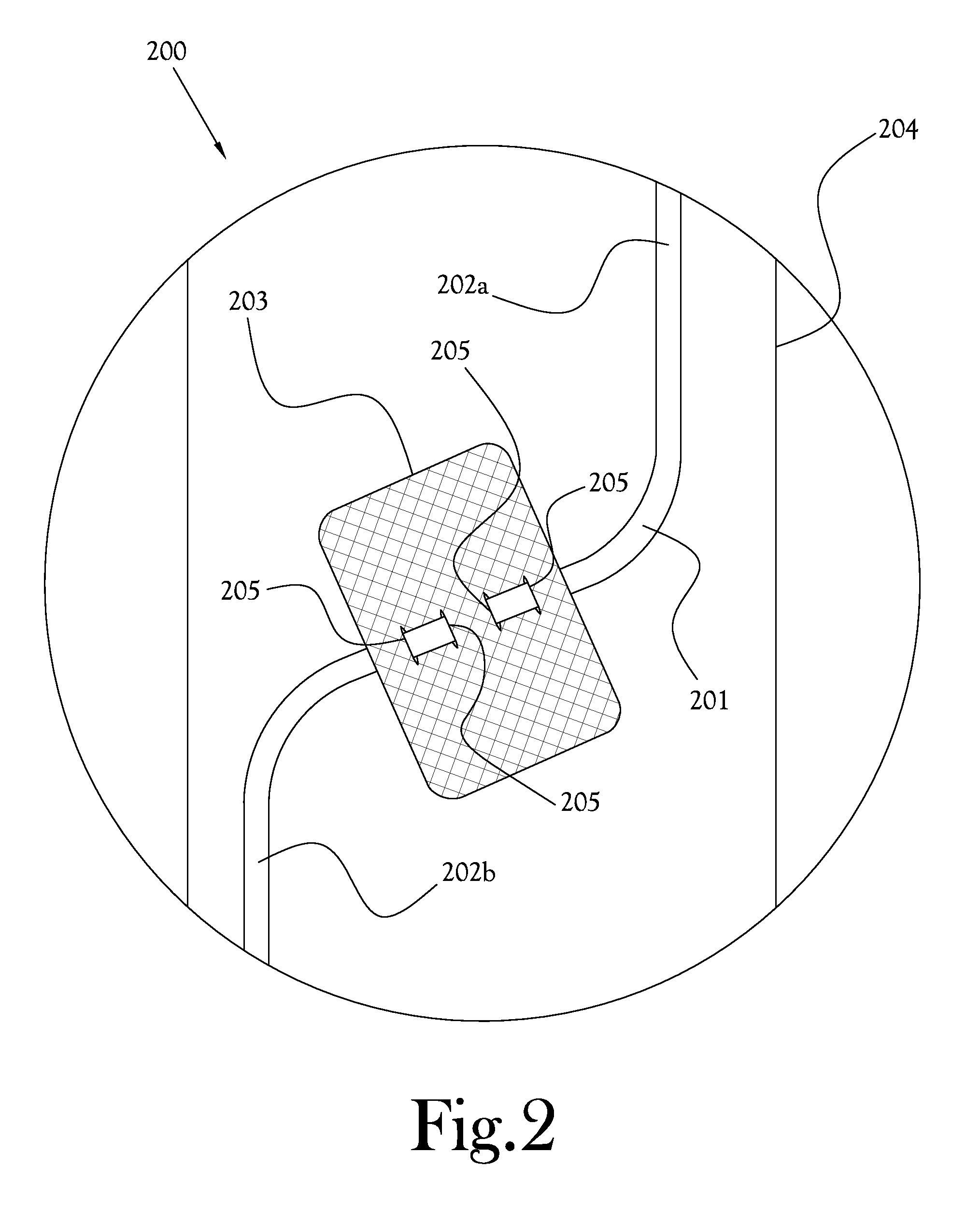 Method of Device Attachment to a Biological Surface