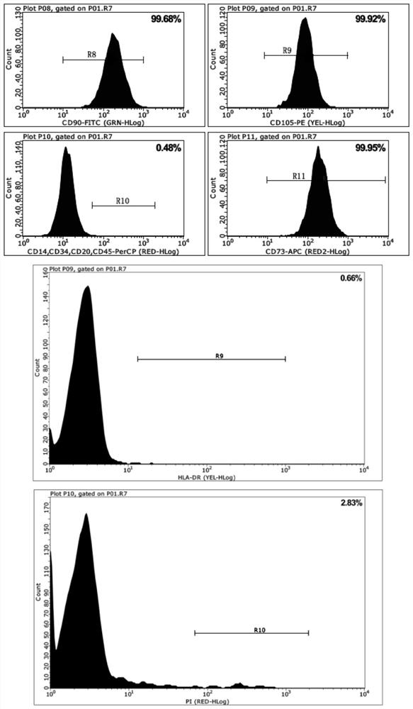 Culture medium for primary umbilical cord mesenchymal stem cells and application of culture medium