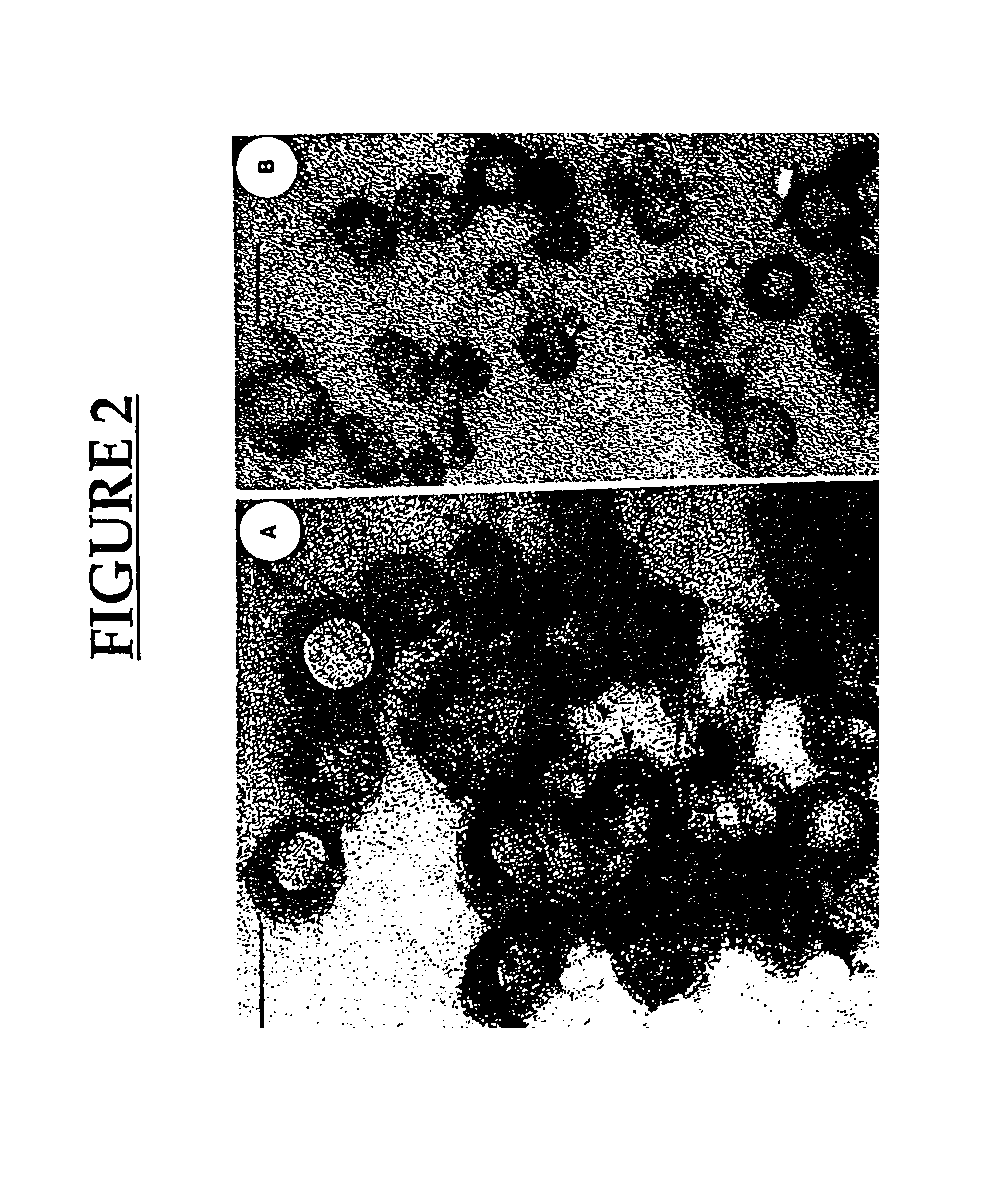 Vaccines and pharmaceutical compositions using membrane vesicles of microorganisms, and methods for preparing same