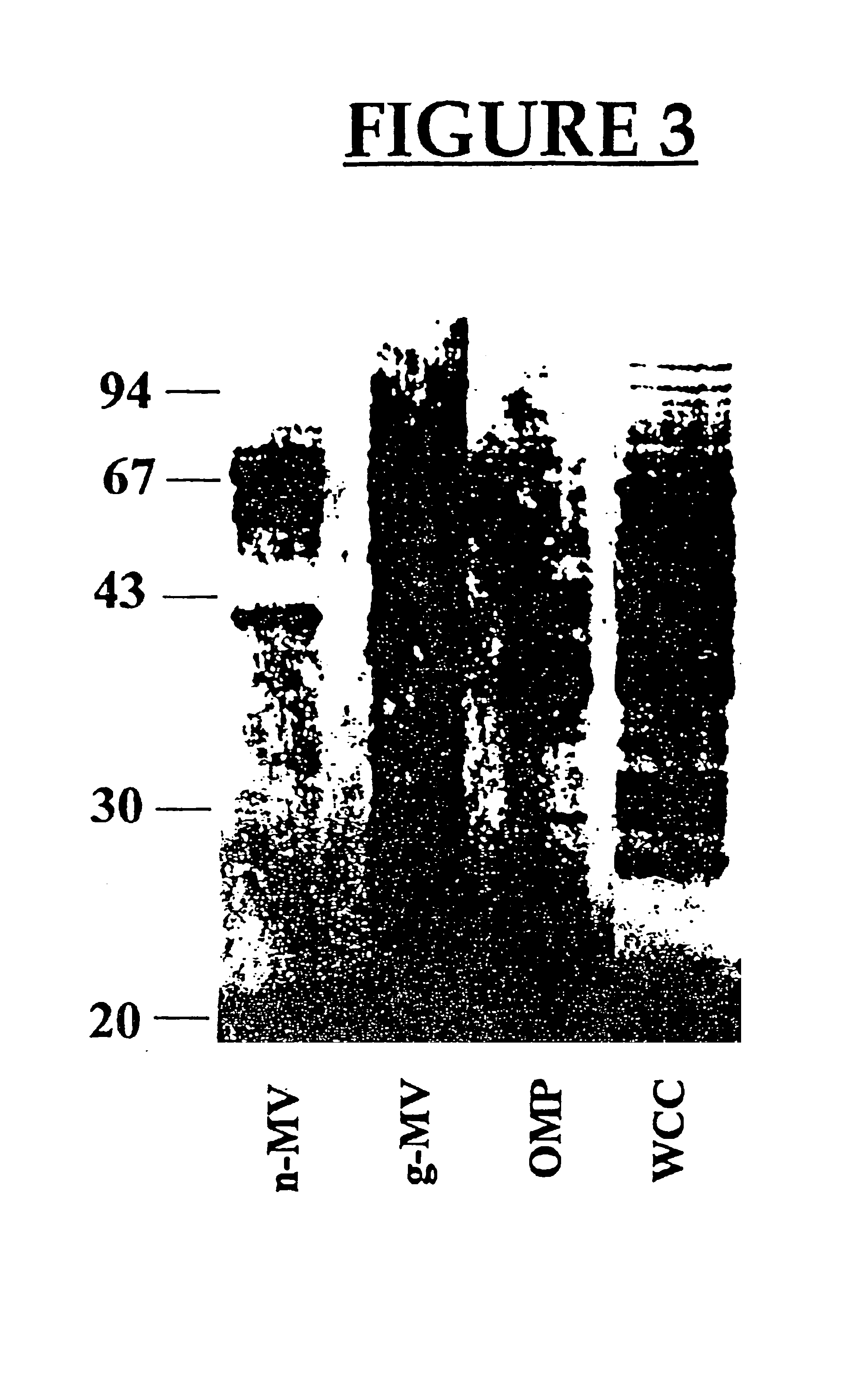 Vaccines and pharmaceutical compositions using membrane vesicles of microorganisms, and methods for preparing same