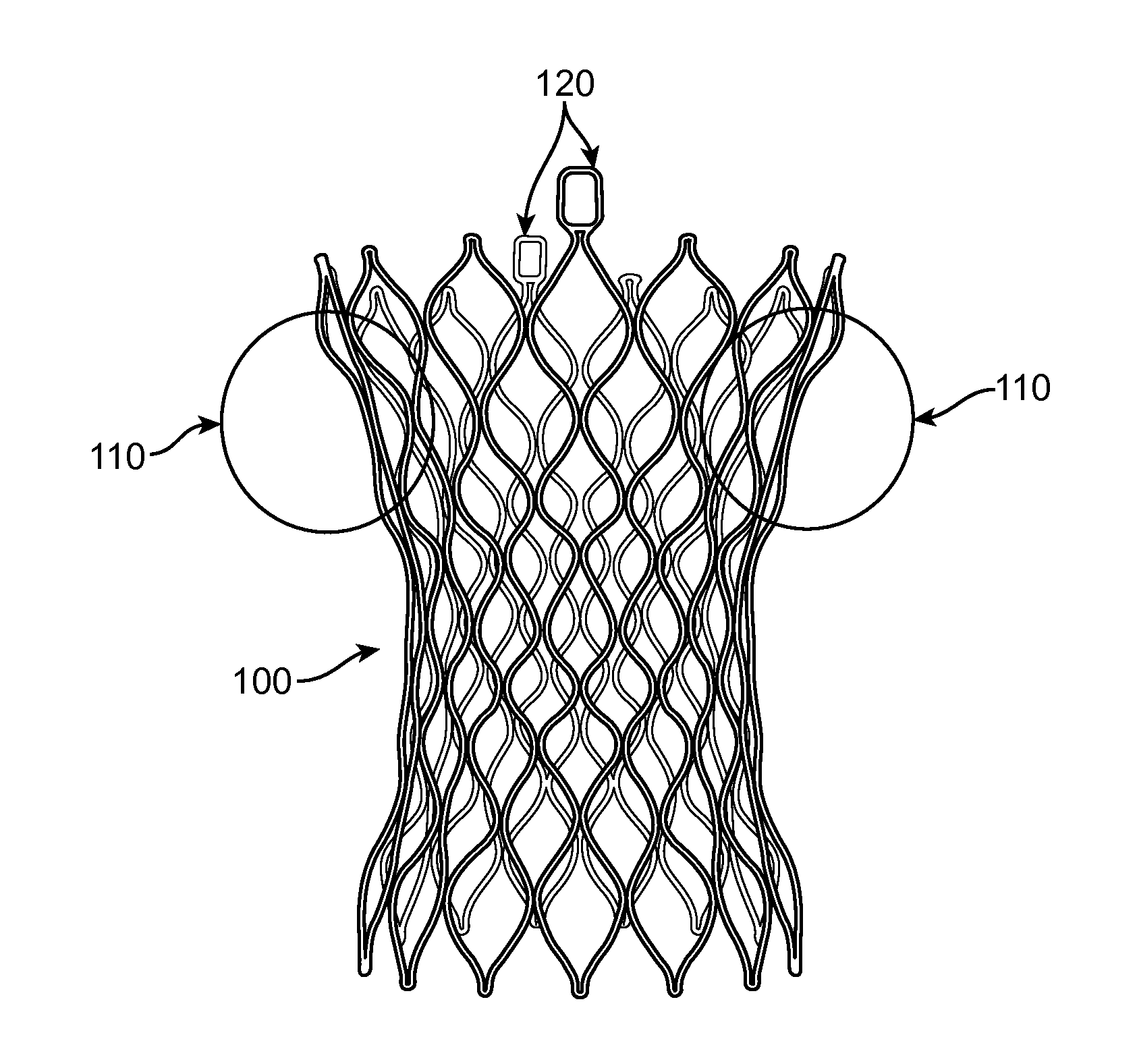 Valve Prosthesis