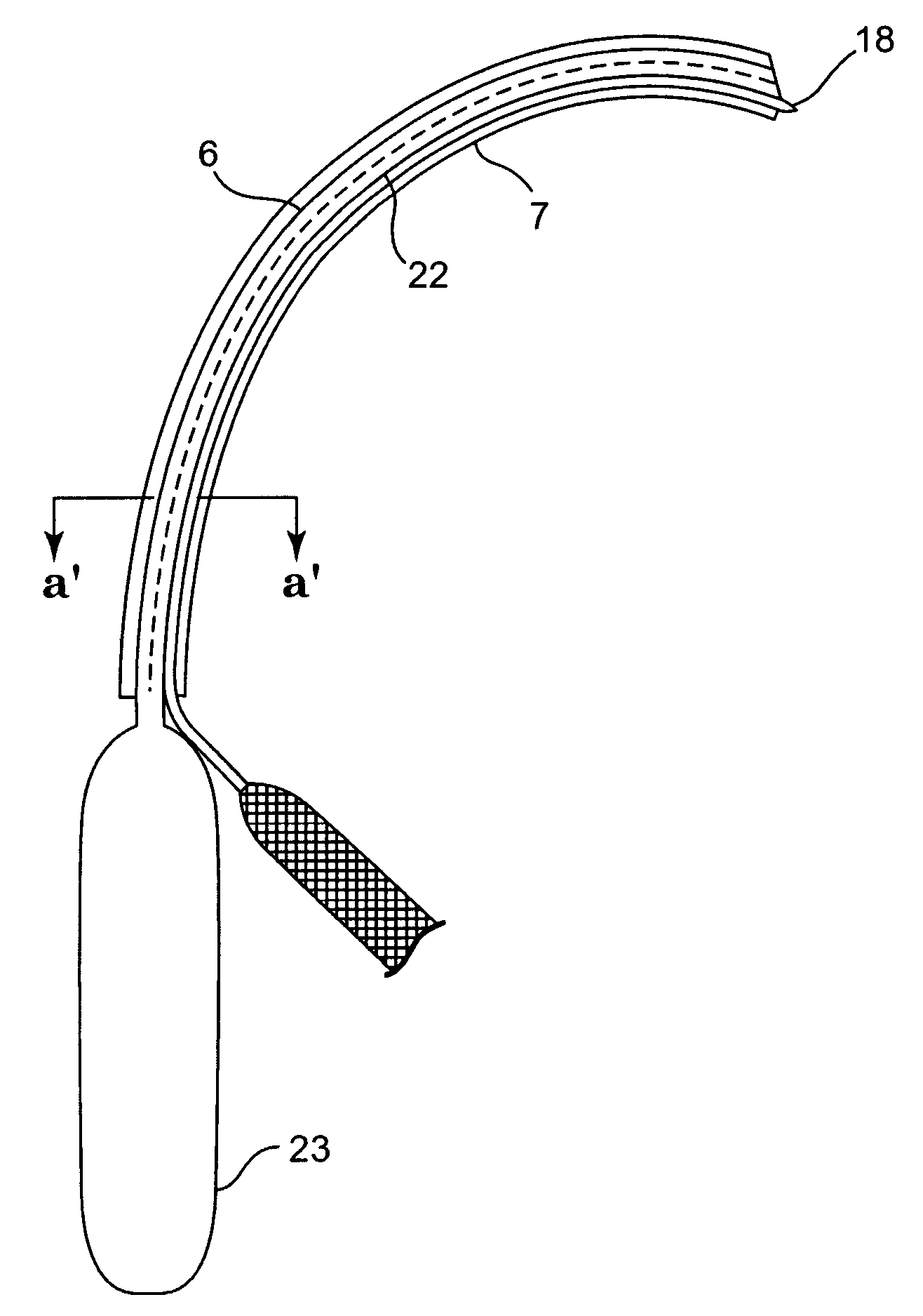 Methods and apparatus for prolapse repair and hysterectomy