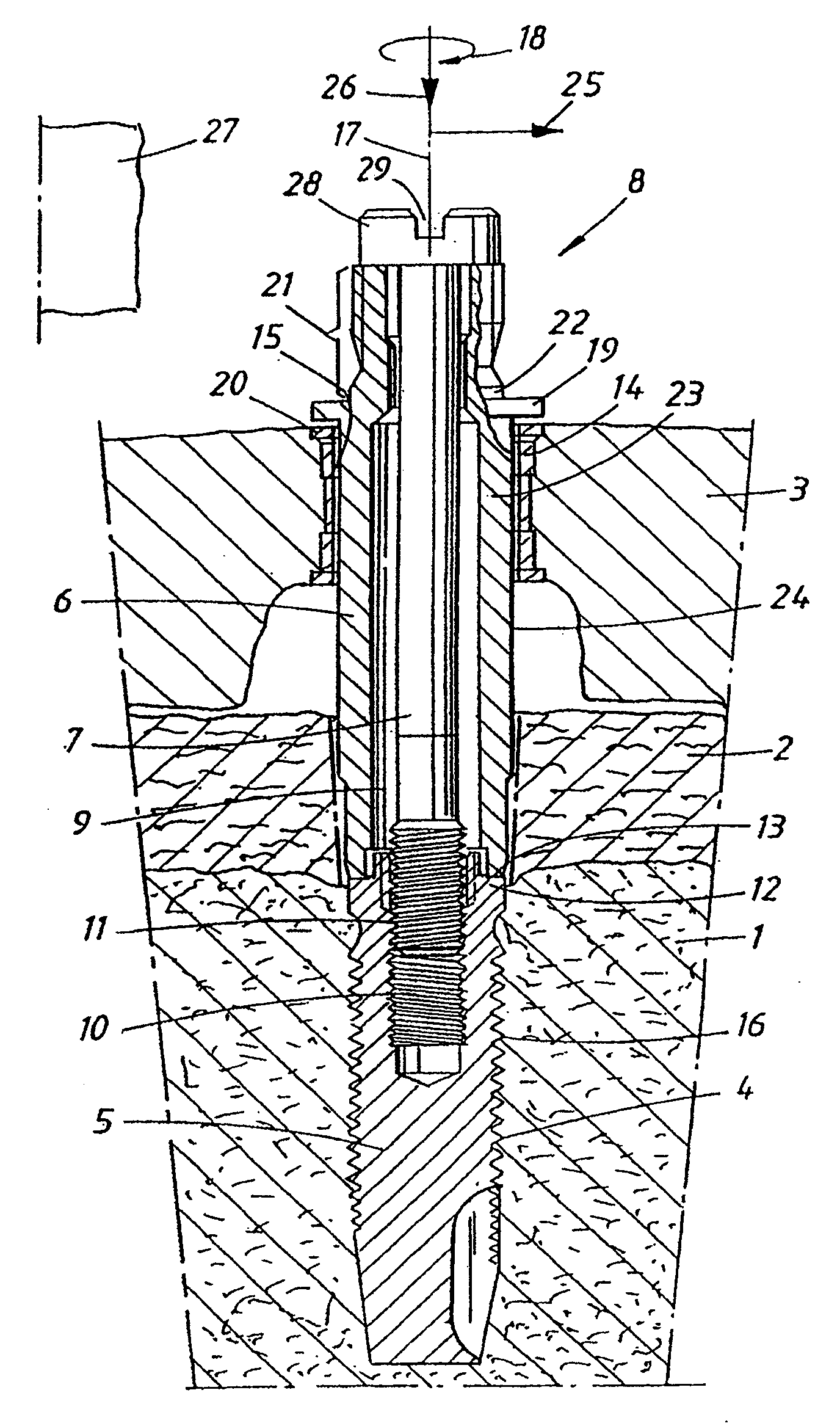 Device and arrangement for fixture installation