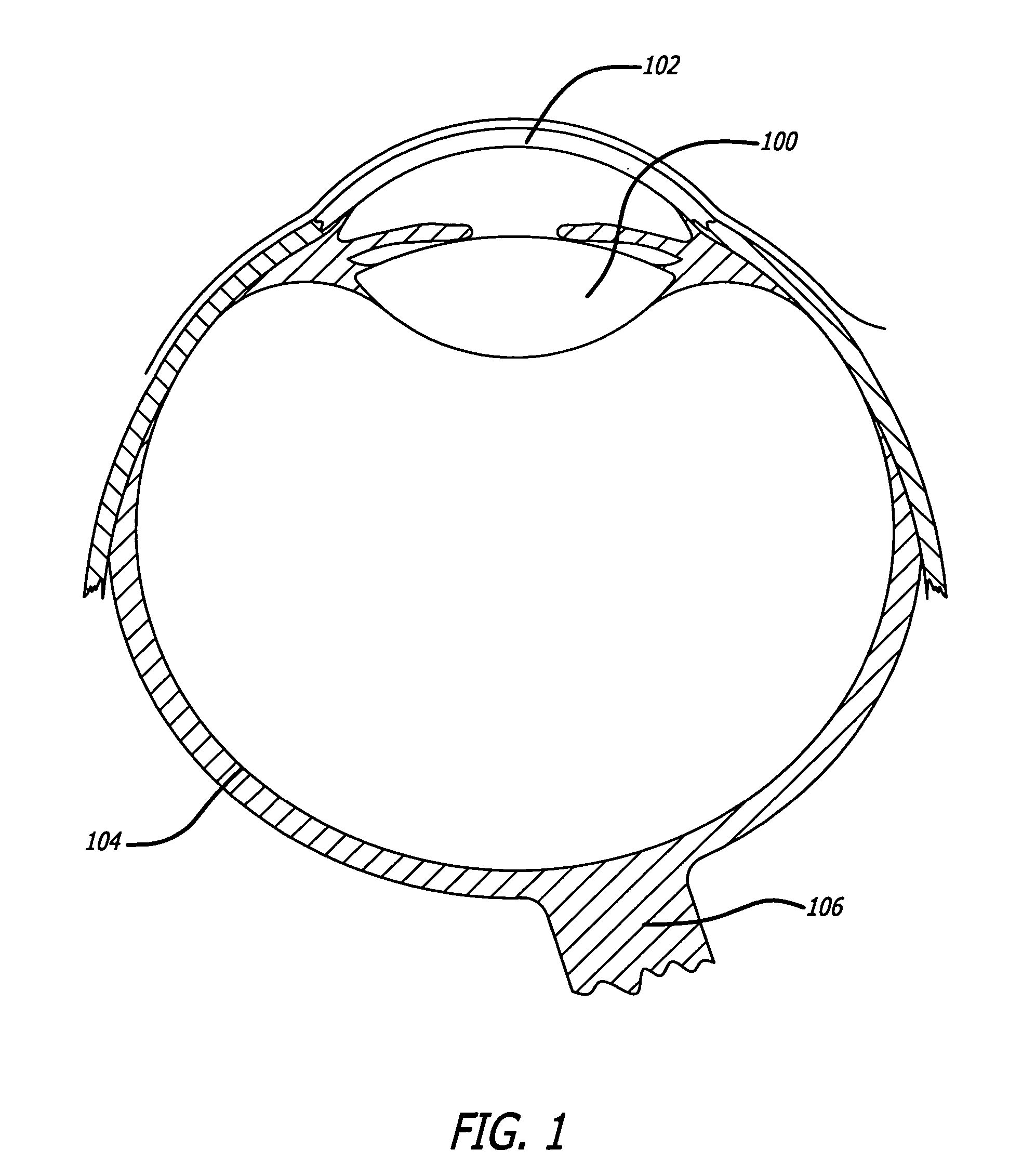 Intraocular lenses having a visible light-selective-transmissive-region