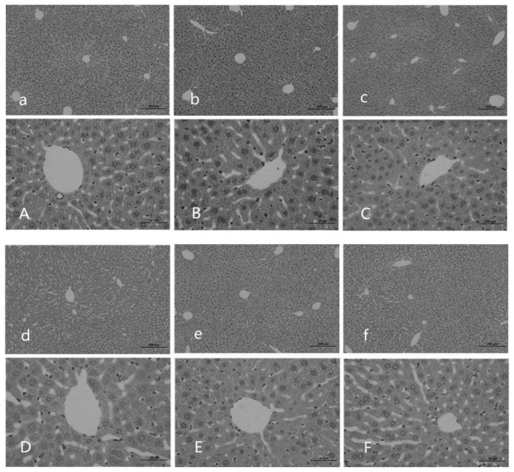 New application of algin in treatment of hepatolenticular degeneration