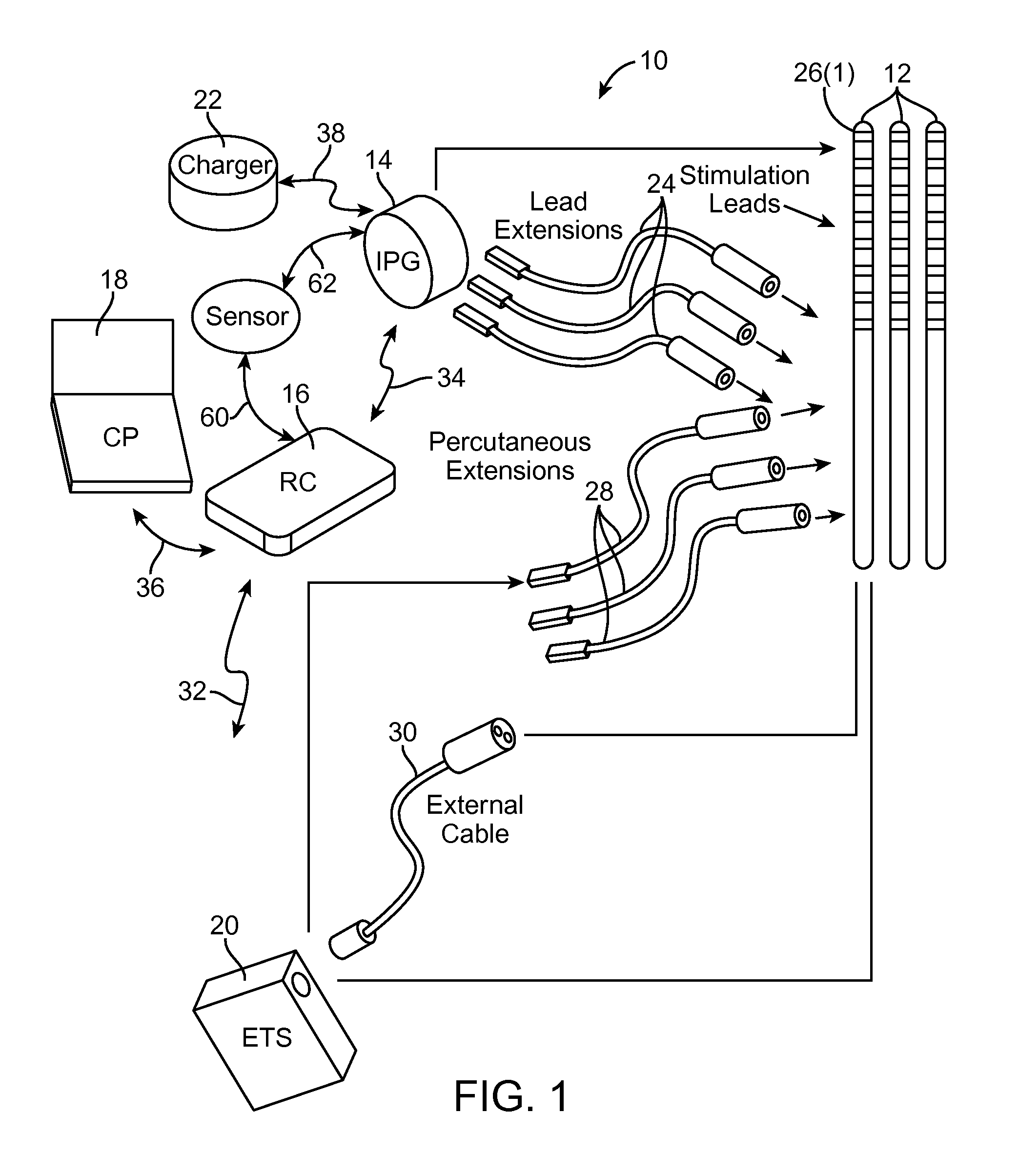 Method for treating hypertension via electrical stimulation of neural structures