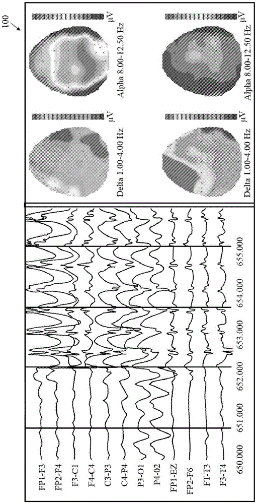 Method and system to calculate quantitative EEG