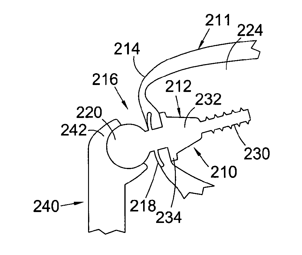 Method of Installing a Percutaneous Device