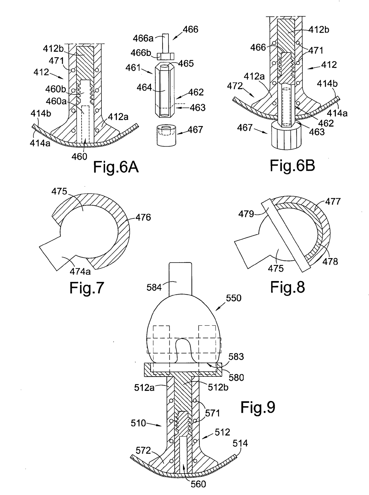 Method of Installing a Percutaneous Device