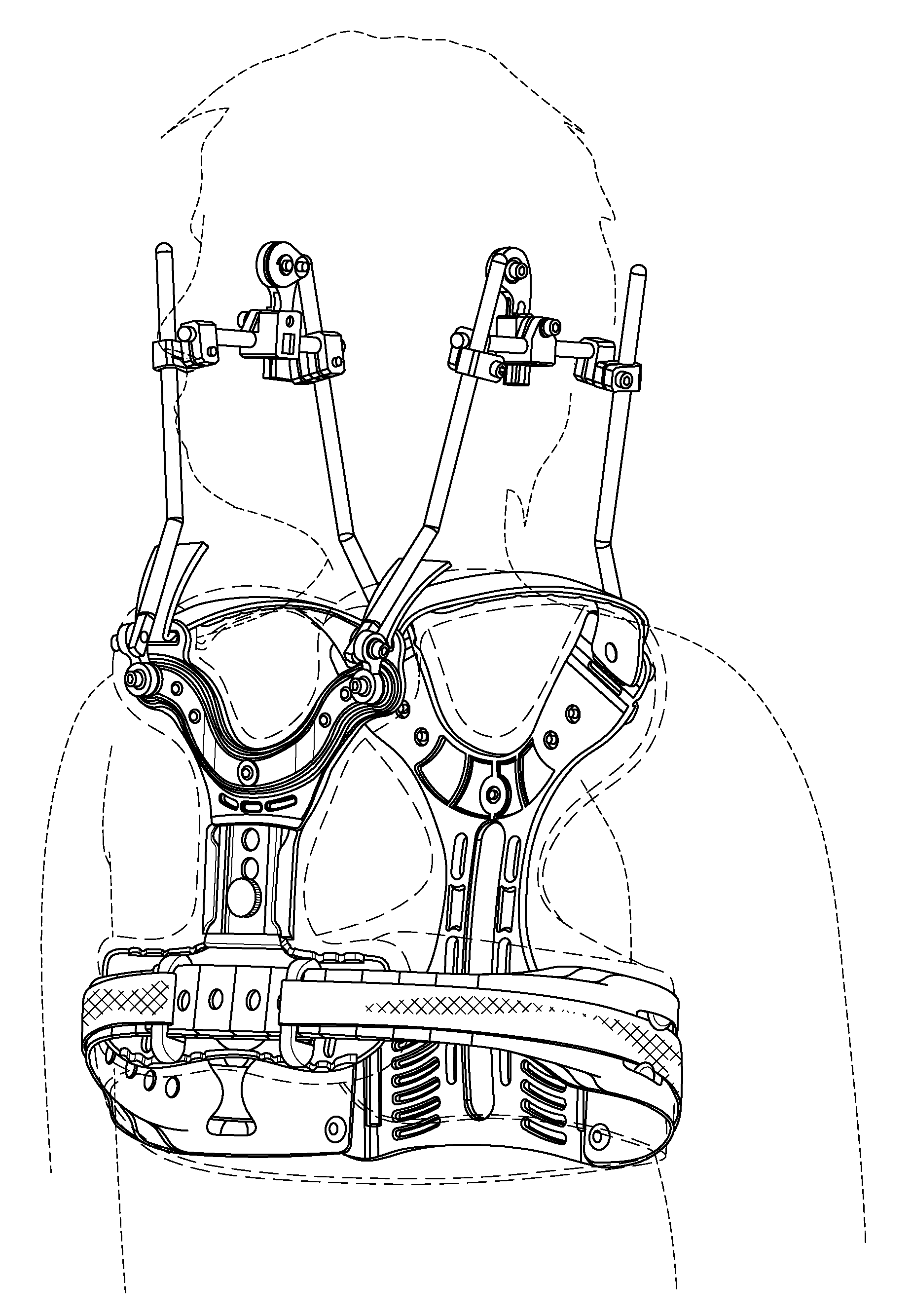 Immobilization device