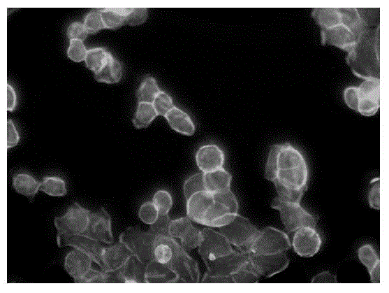 Application of maprotiline hydrochloride in preparation of medicine for inhibiting tumour cell transfer and diffusion