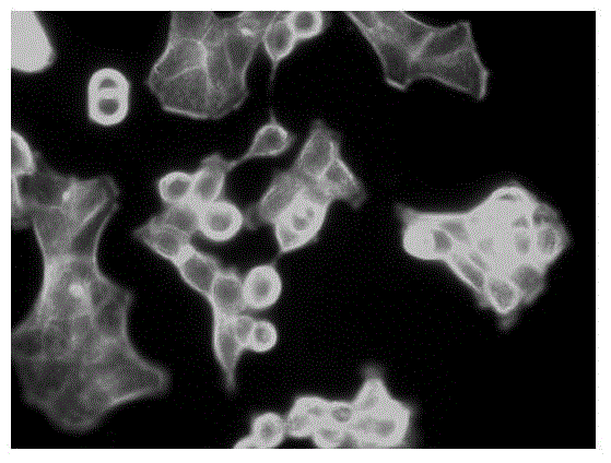 Application of maprotiline hydrochloride in preparation of medicine for inhibiting tumour cell transfer and diffusion