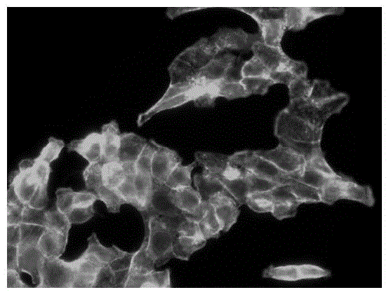 Application of maprotiline hydrochloride in preparation of medicine for inhibiting tumour cell transfer and diffusion