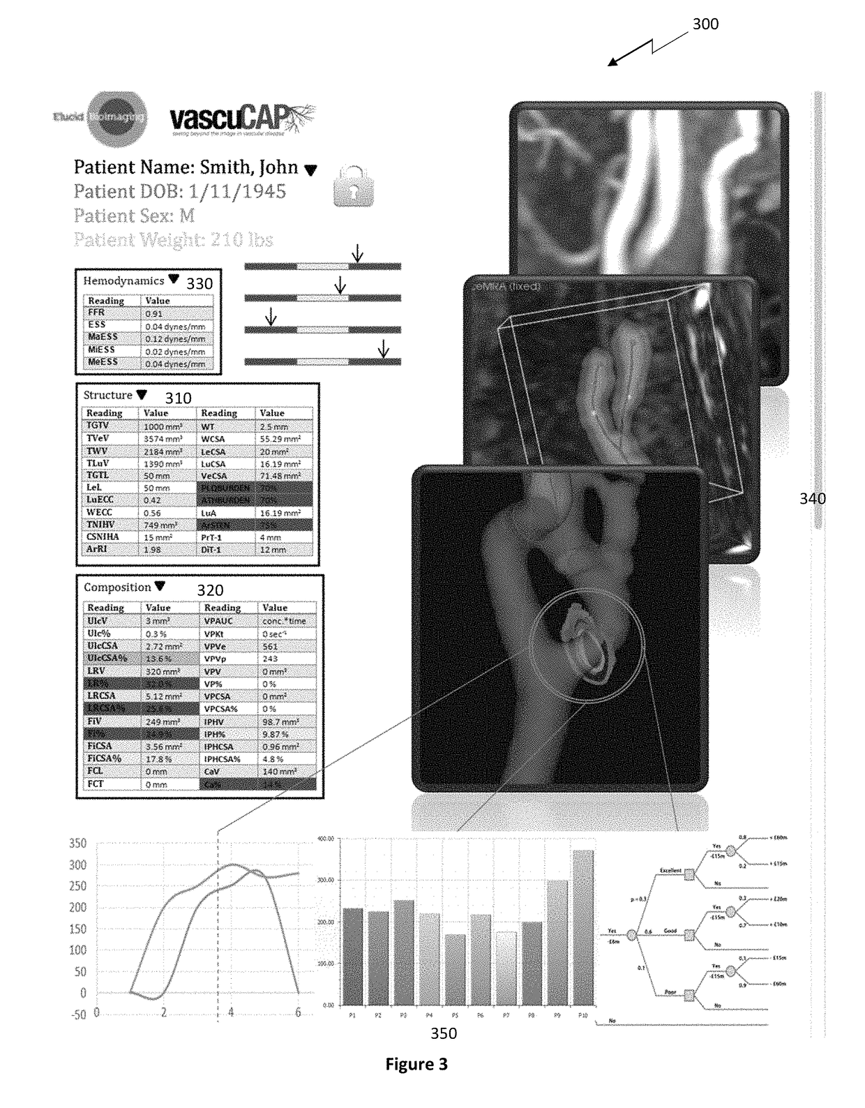 Systems and methods for analyzing pathologies utilizing quantitative imaging