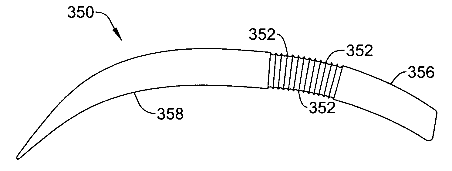 Flexible subcutaneous implantable cardioverter-defibrillator