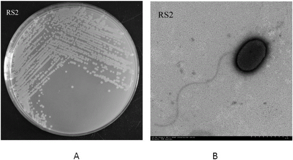 Root surface film forming bacterium RS2 with phenanthrene degradation function and application of root surface film forming bacterium RS2