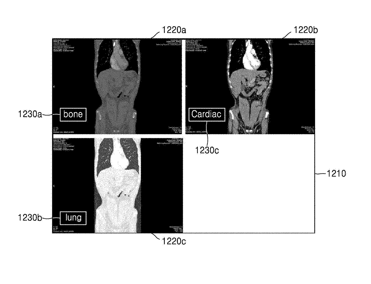 Apparatus and method of processing computed tomography image