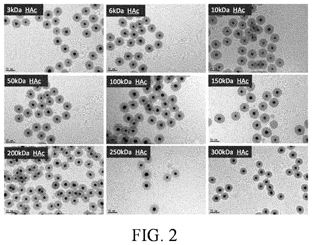 Therapy for glioblastoma multiforme