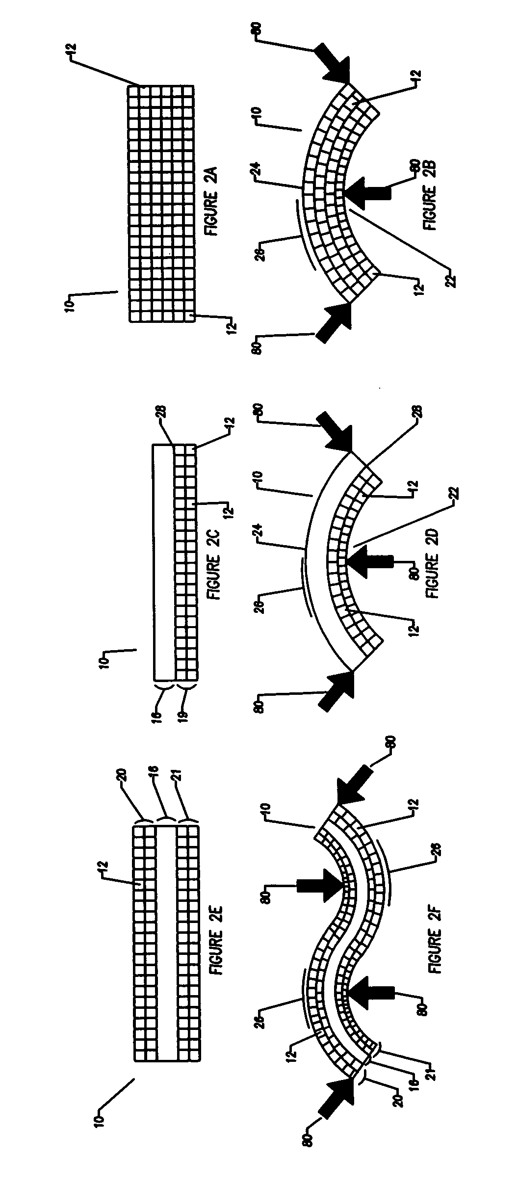 Compliant osteosynthesis fixation plate