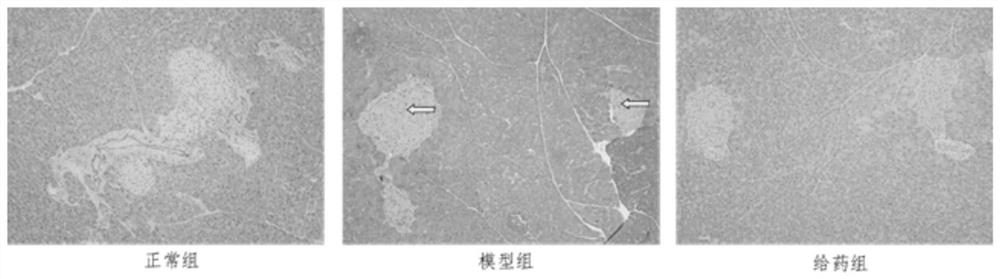 Preparation method of traditional Chinese medicine extract for regulating glycolipid metabolism