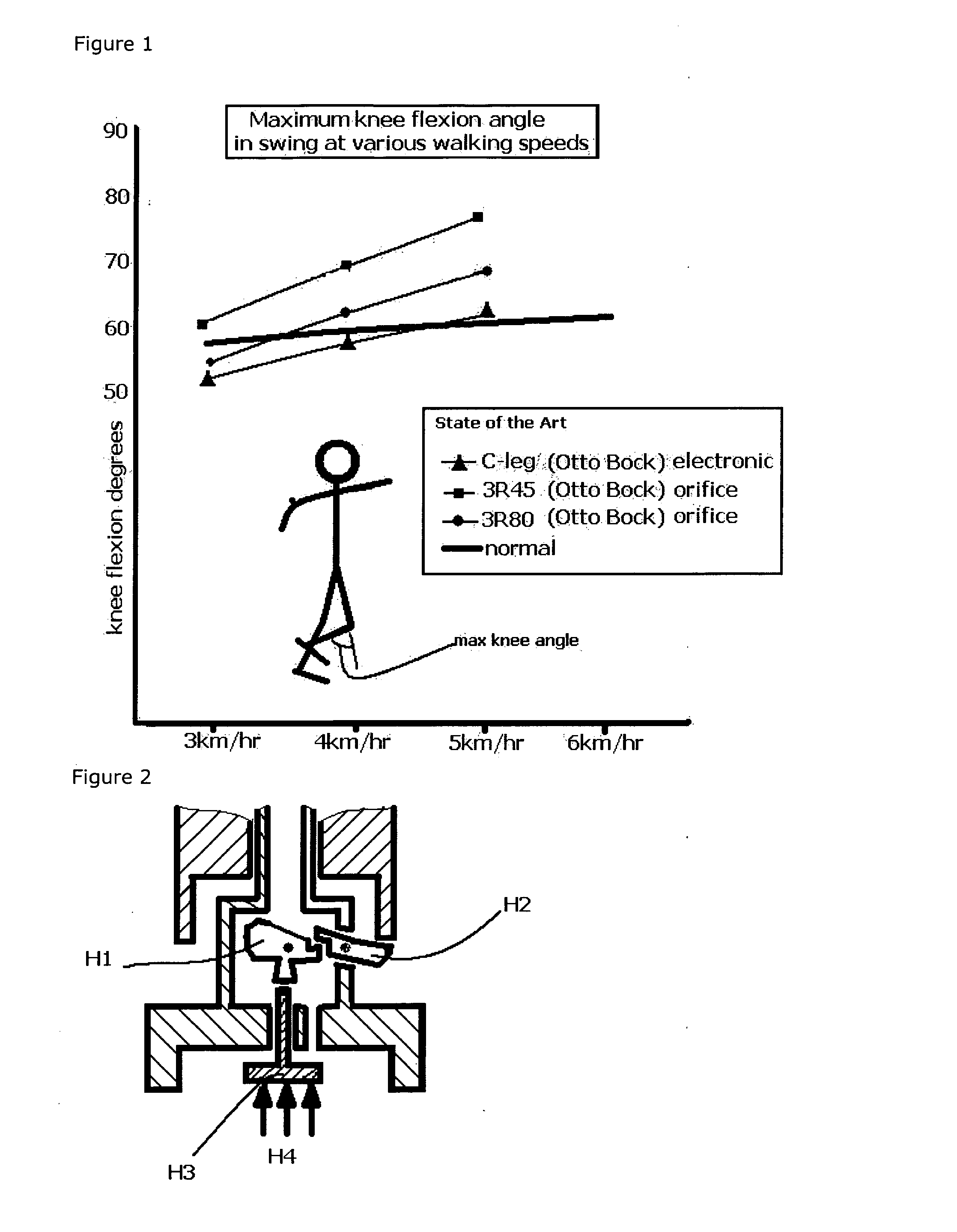 Hydraulic prosthetic joint