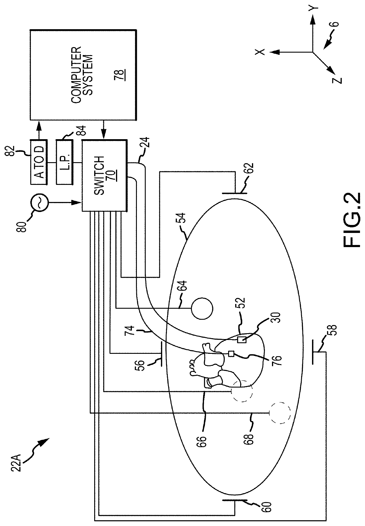 Method for medical device localization based on magnetic and impedance sensors