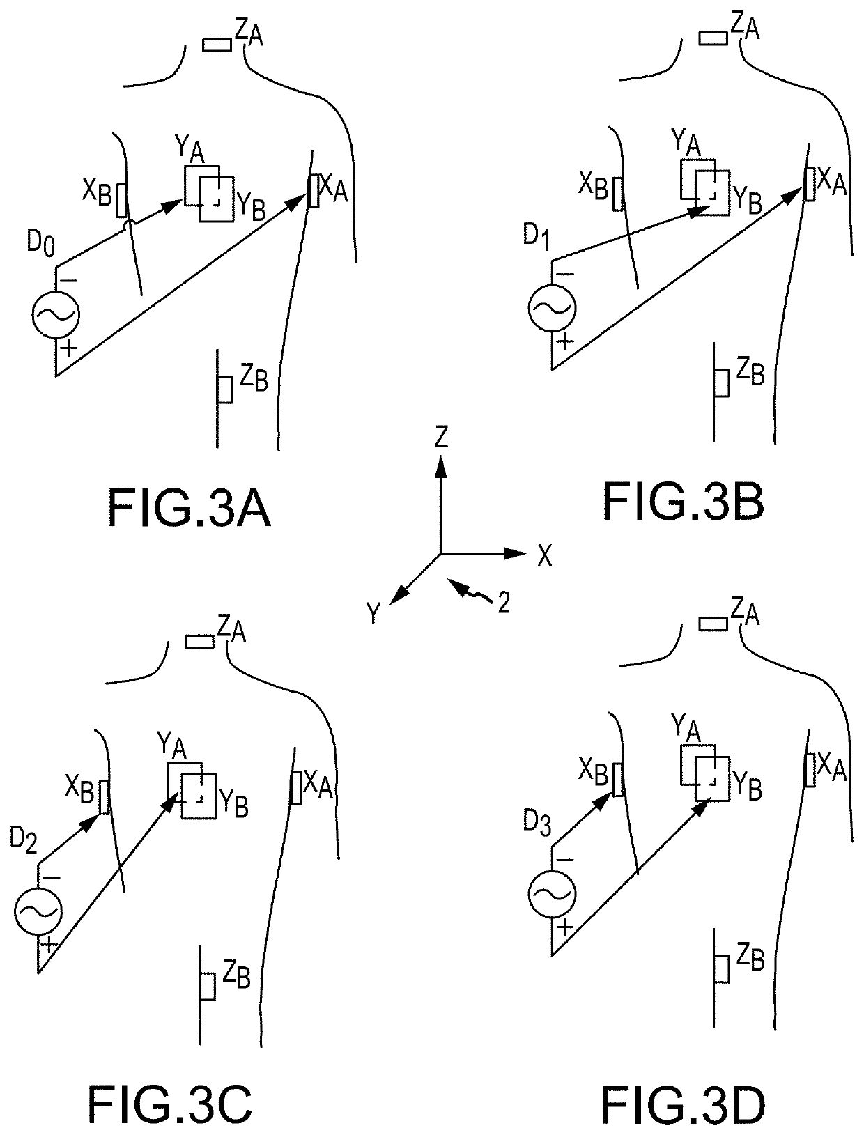 Method for medical device localization based on magnetic and impedance sensors