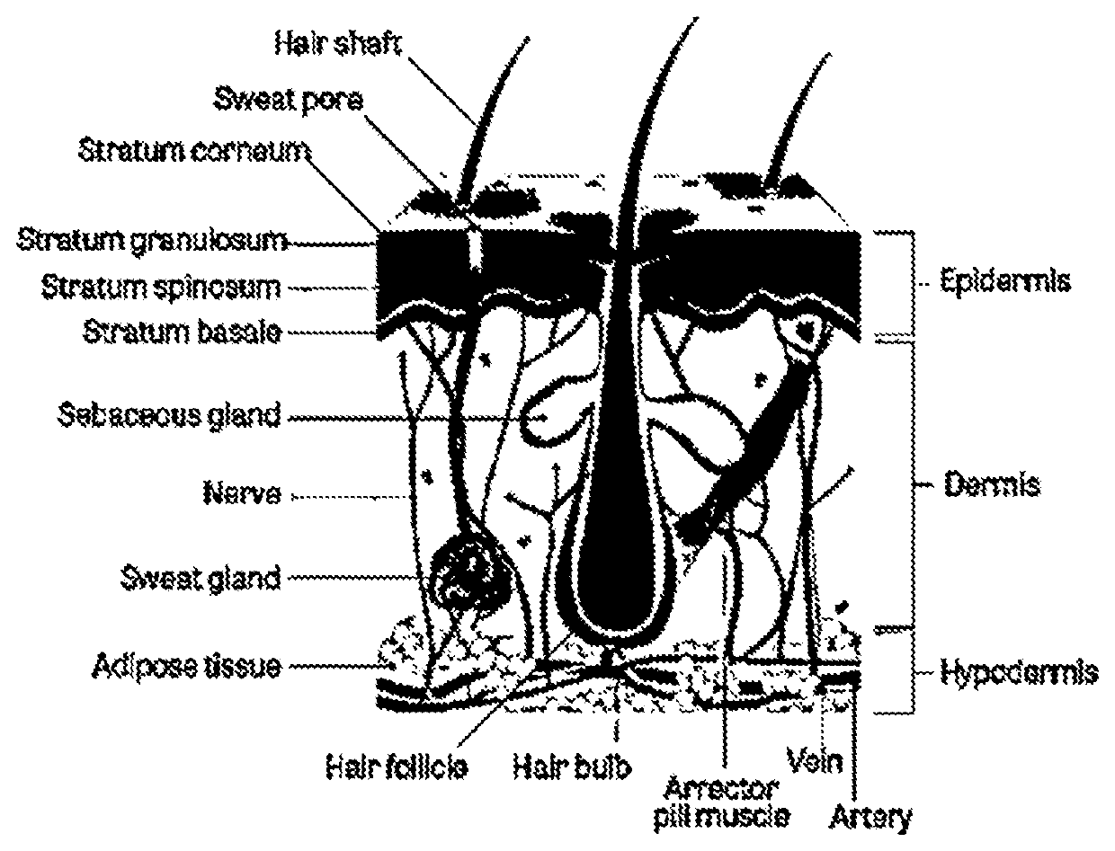 Topical dutasteride emulsions for treating endocrine therapy-induced alopecia