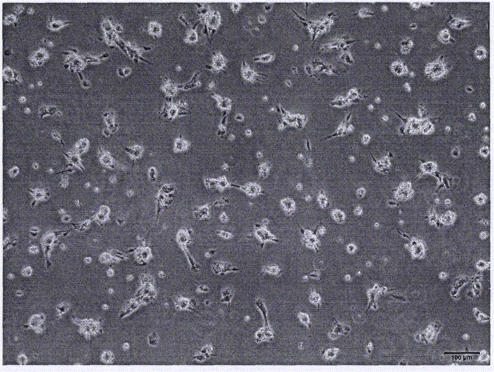 Rat hepatic stellate cell separation method