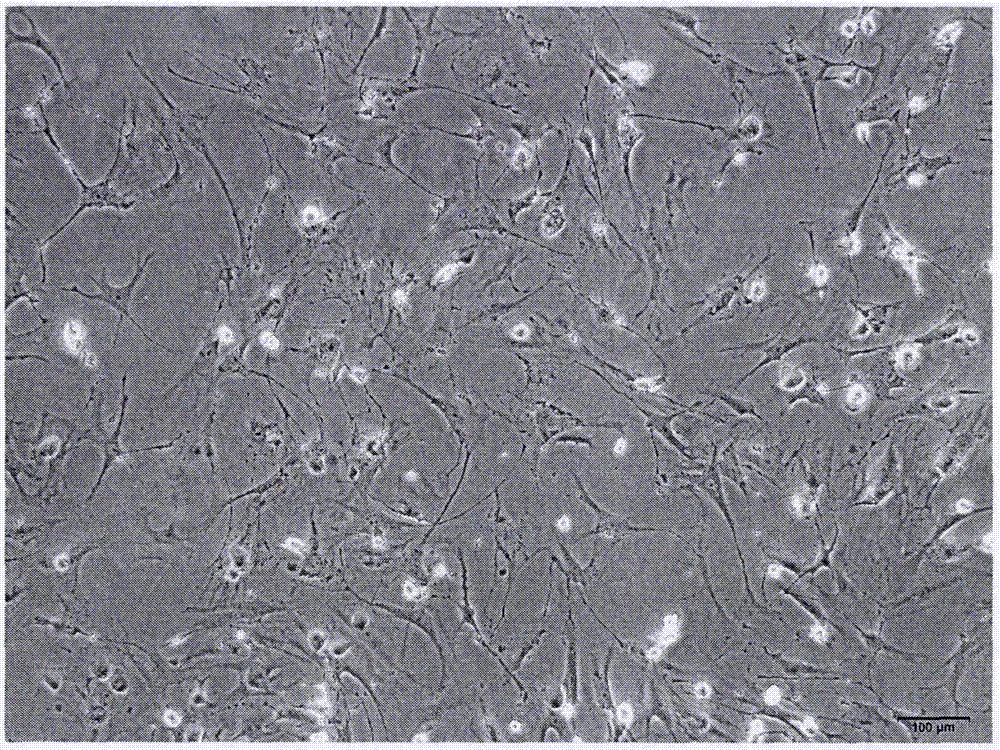 Rat hepatic stellate cell separation method