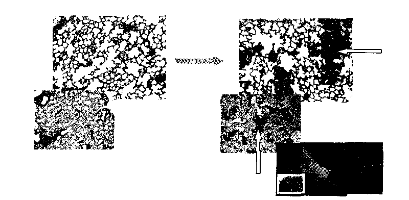 Human breast cancer cell line with high lung metastasis