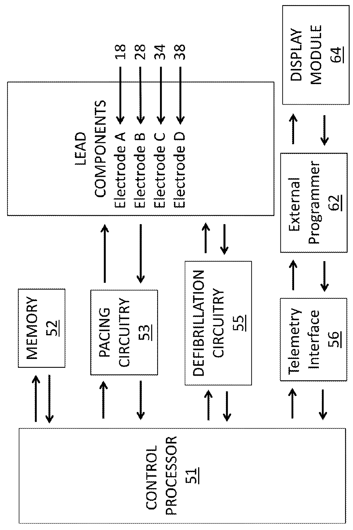 Systems and methods to optimize Anti-tachycardial pacing (ATP)