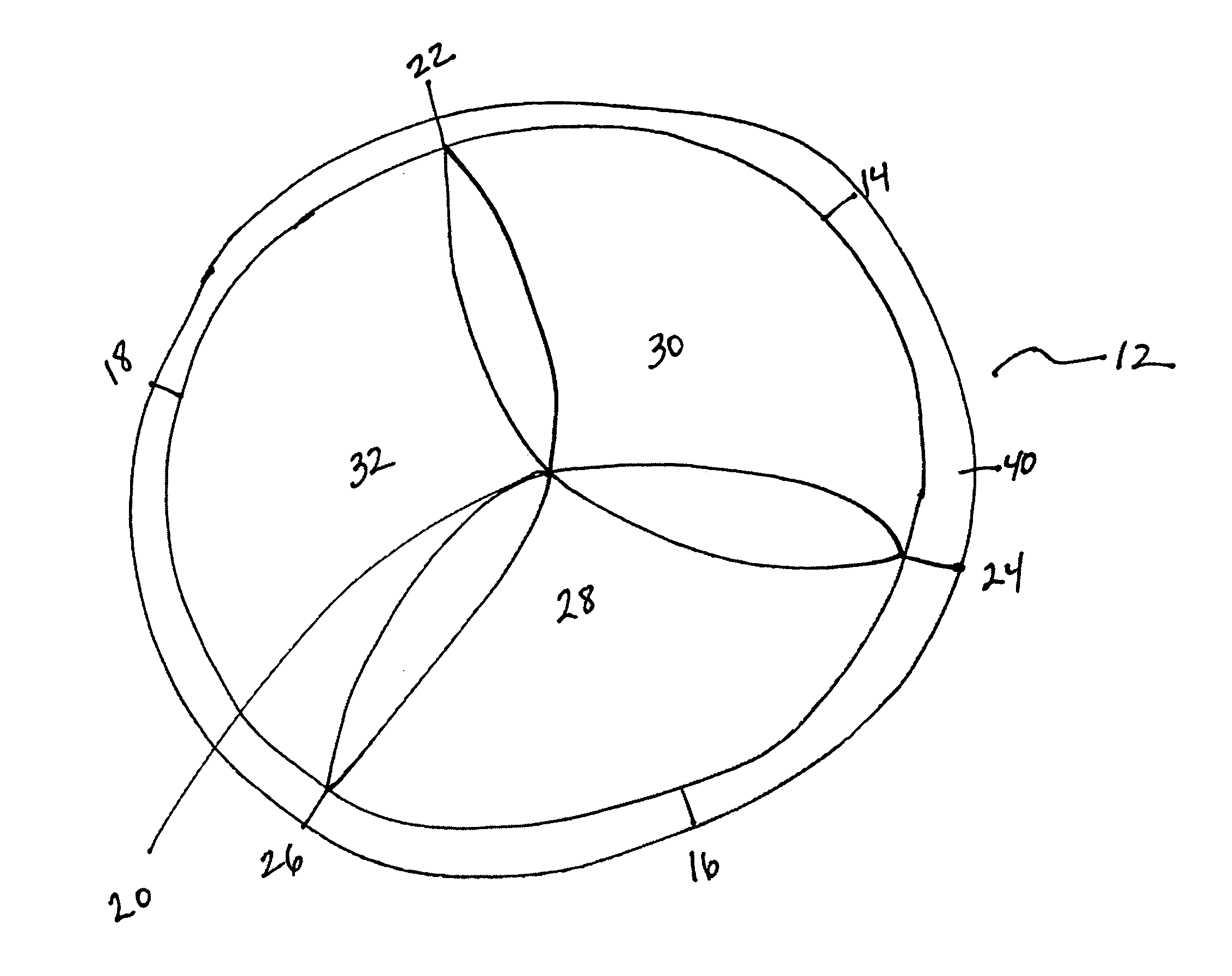 Trileaflet Semi-Lunar Prosthetic Tissue Valve