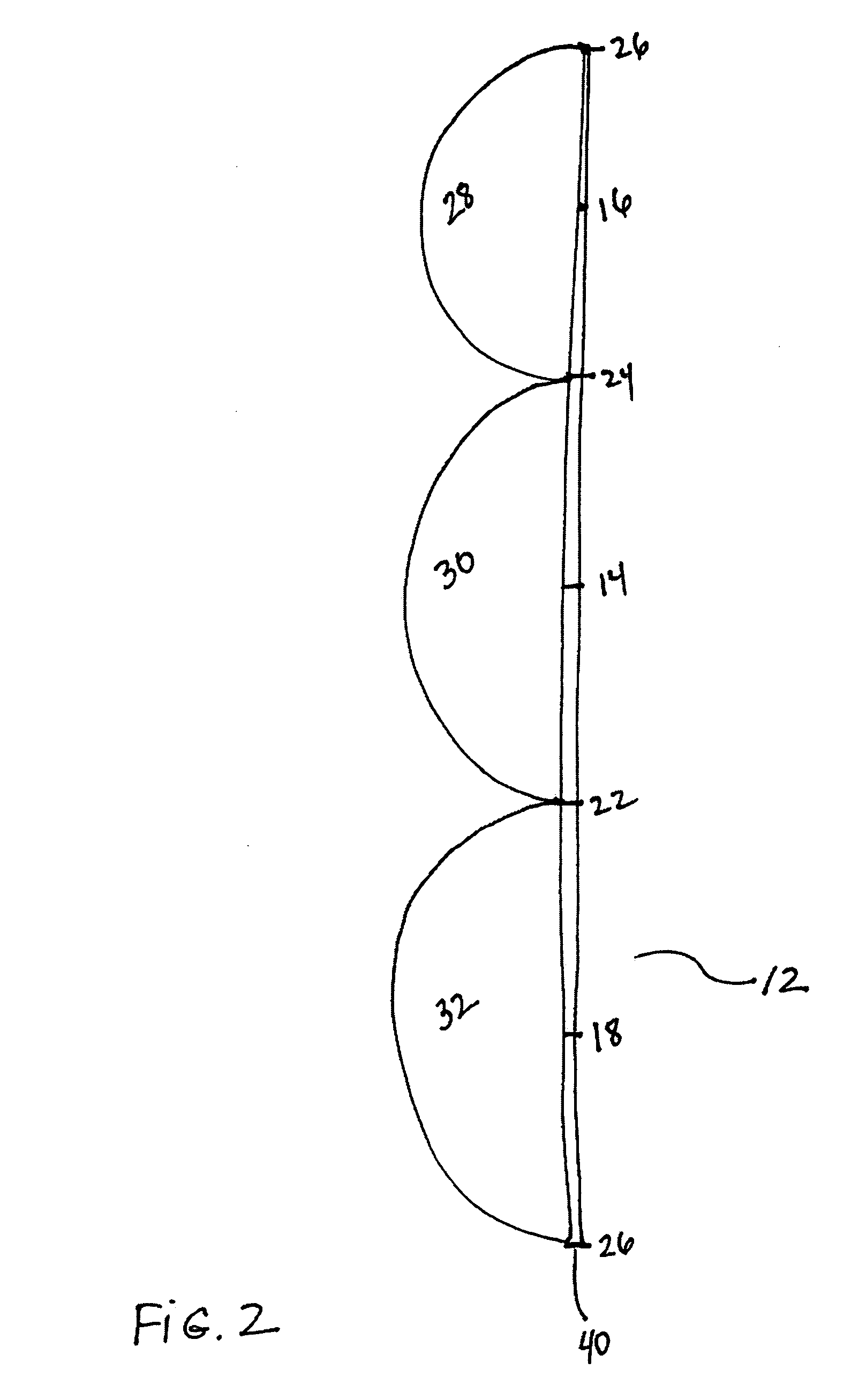 Trileaflet Semi-Lunar Prosthetic Tissue Valve